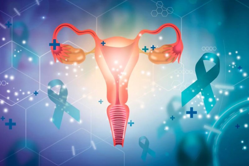 Endometrioza lidhet me shanse shumë më të larta për kancer të vezoreve